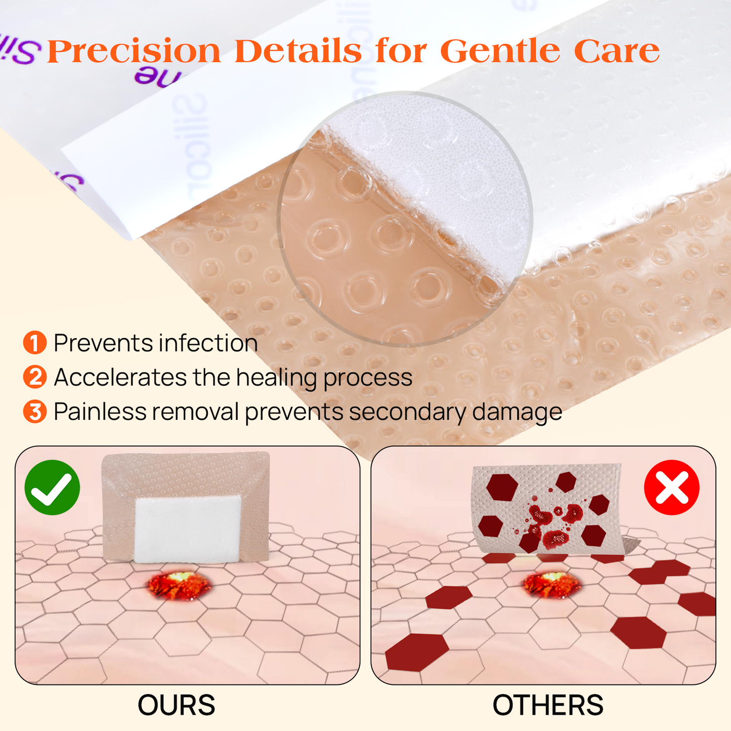 Silicone Foam Dressing - Long Adhesive Foam Bandage for Surgical Incisions and Wound Care, Waterproof and Gentle on Skin 4"×12" （5pcs）